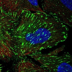 TNS3 Antibody, Novus Biologicals 25 &mu;L, Unlabeled:Antibodies, Polyclonal